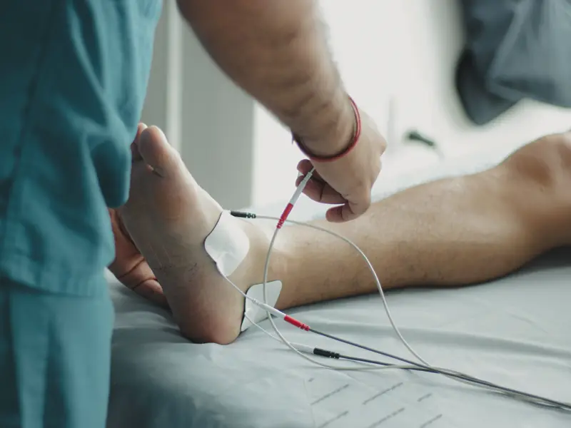 Sensor pads and leads placed on a foot and lower leg for a simple nerve test